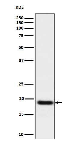 TNFAIP8 Rabbit mAb