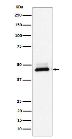 DNAJA4 Rabbit mAb