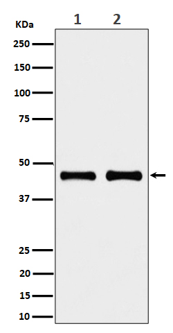 NDUFS2 Rabbit mAb