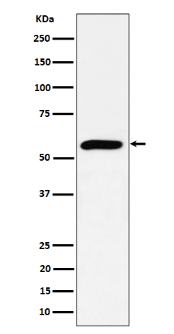 PRPF4 Rabbit mAb