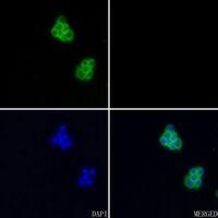 Aggrecan Antibody