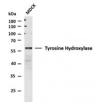 Tyrosine Hydrolase Mouse mAb