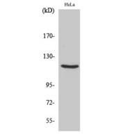 PR Polyclonal Antibody