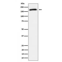 AS160 (Phospho-Thr642) Rabbit mAb