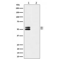 CaMKII alpha (Phospho-Thr286) Rabbit mAb