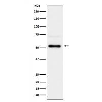 Chk1 (Phospho-Ser280) Rabbit mAb