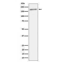 ErbB2(Phospho-Tyr1221 / Tyr1222)  Rabbit mAb 