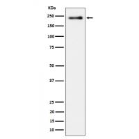 LRP6 (Phospho-Ser1490) Rabbit mAb