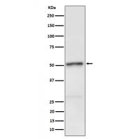 RIP3 (Phospho-Ser232) Rabbit mAb