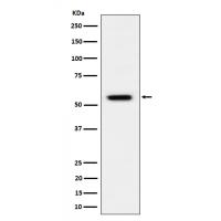 Phospho-Vimentin (S39) Rabbit mAb