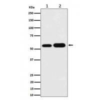 AKT1/2/3 Rabbit mAb