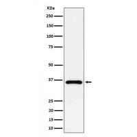 GAS2 Rabbit mAb