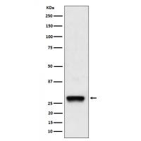 PDGF B Rabbit mAb