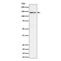 Ceruloplasmin Rabbit mAb