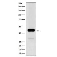 NFE2 Rabbit mAb