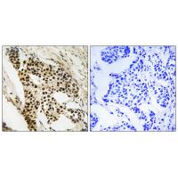 MAPKAPK-2 Polyclonal Antibody