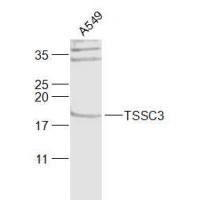 PHLDA2 antibody