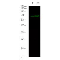 Estrogen Receptor-α (Phospho-Thr311) Antibody