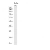 ROS (Phospho-Tyr2274) Antibody