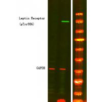 Leptin Receptor (Phospho-Tyr986) Antibody