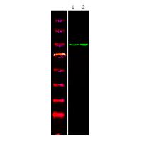 Androgen Receptor (Phospho-Tyr534) Antibody