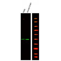 NDRG2 (Phospho-Thr348) Antibody