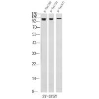 FGFR3 (Phospho-Tyr724) Antibody