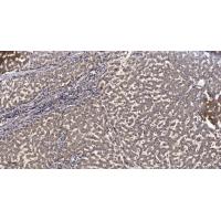 IRAK-2 Polyclonal Antibody