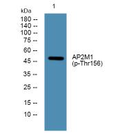 AP-2mu (Phospho-Thr156) Antibody