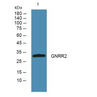 GNRHR2 Antibody