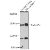 Collagen XVI α1 Antibody