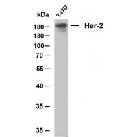 Her-2 mouse mAb(ABT008)