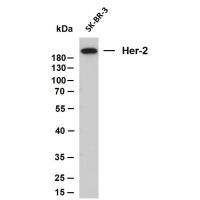 Her-2 mouse mAb(ABT008)