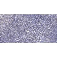 PTGR2 Polyclonal Antibody