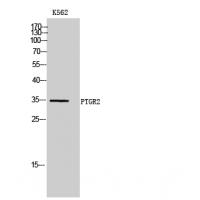 PTGR2 Polyclonal Antibody