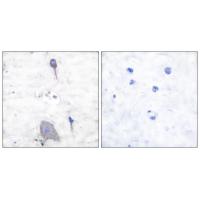 SIRP-α1 Polyclonal Antibody