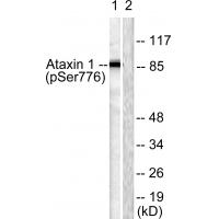 Ataxin 1 (Phospho-Ser776) Antibody