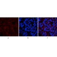 CaMK2- beta/ gamma/ delta (Phospho-Thr287) Antibody