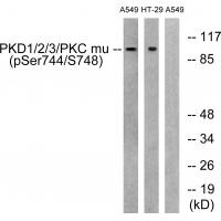 PKD1/2/3/PKC μ (Phospho-Ser738/742) Antibody