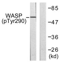 WASP (phospho Tyr290) Polyclonal Antibody