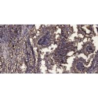 PLC β2 Polyclonal Antibody