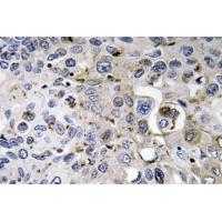 PDGF-A Polyclonal Antibody