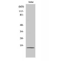 PDGF-A Polyclonal Antibody