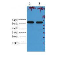 AFP alpha 1 Fetoprotein Monoclonal Antibody