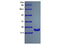 Recombinant Human Tumor Necrosis Factor-alpha/TNFSF2, His