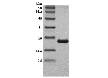 Recombinant Human Tumor Necrosis Factor-beta/TNFSF1