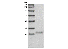 Recombinant Human TNF-related Weak Inducer of Apoptosis Receptor/TNFRSF12A