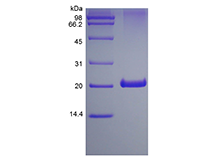 Recombinant Human 4-1BB Receptor/TNFRSF9