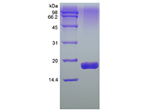 Recombinant Human soluble Tumor Necrosis Factor-Related Apoptosis-inducing Ligand Receptor-2/TNFRSF10B