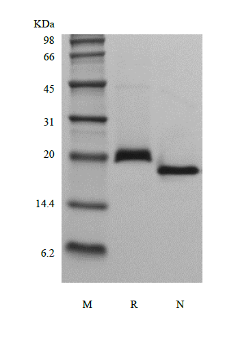 Recombinant Human soluble Receptor Activator of Nuclear Factor kappa-B Receptor/TNFRSF11A